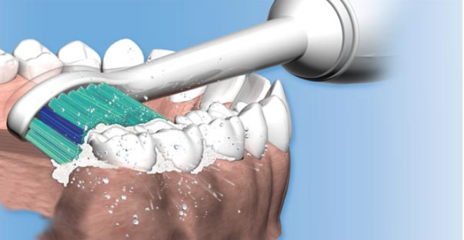 Cepillos De Dientes Sónicos Cepillos De Dientes Sónicos